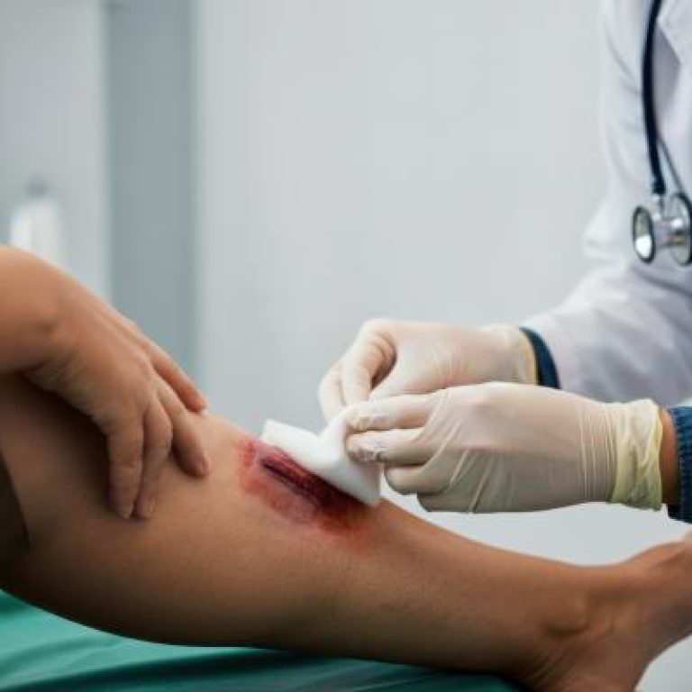 Gangrene