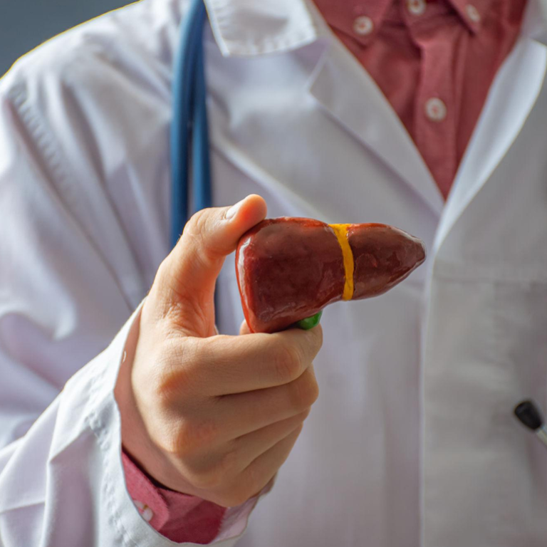Liver Cirrhosis 1